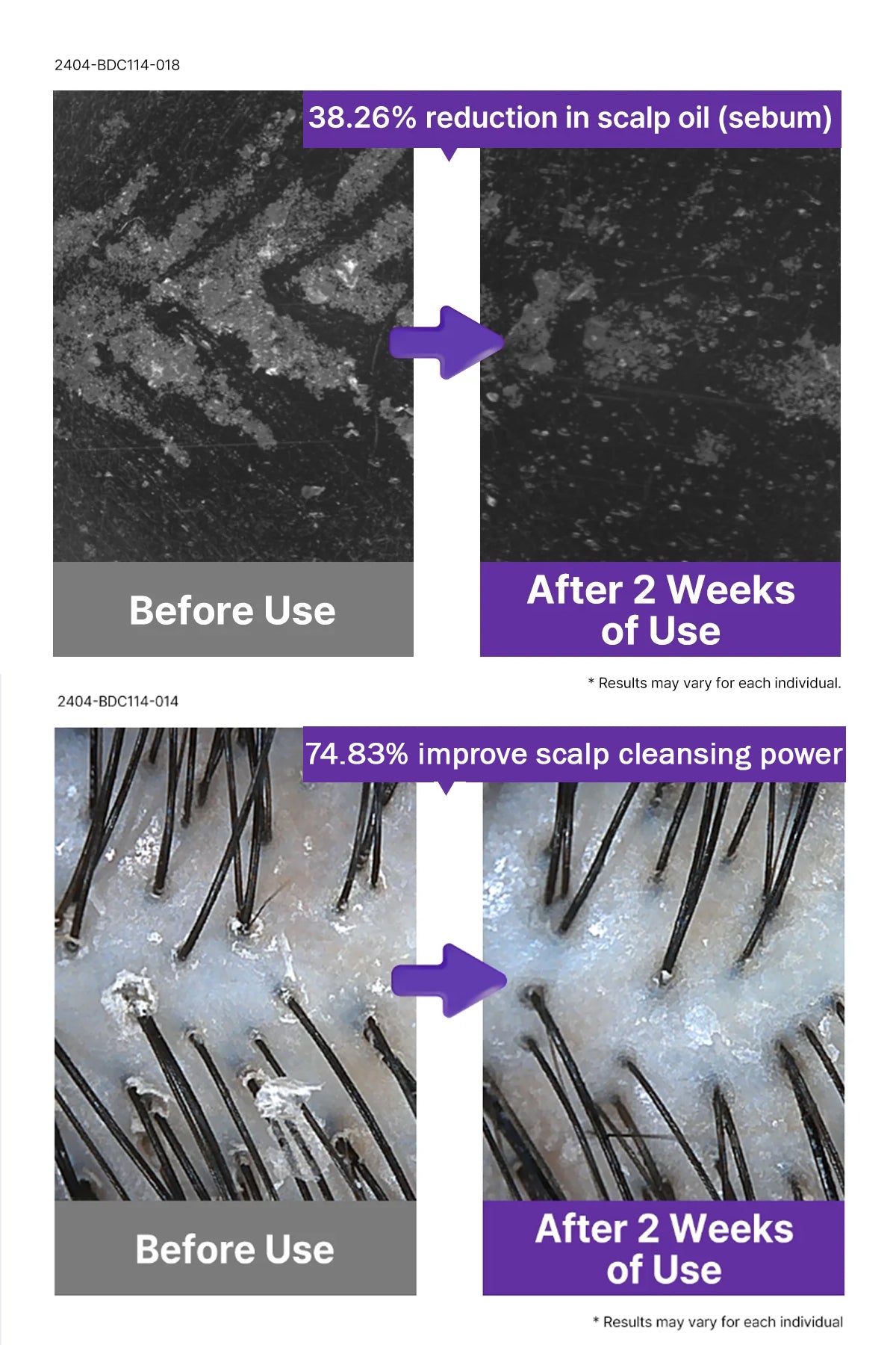 Dr. Oracle Scalp Pore Control Shampoo – Deep Cleansing & Scalp Renewal with PDRN, Plant Proteins & Peptides (380ml / 12.85 fl.oz)