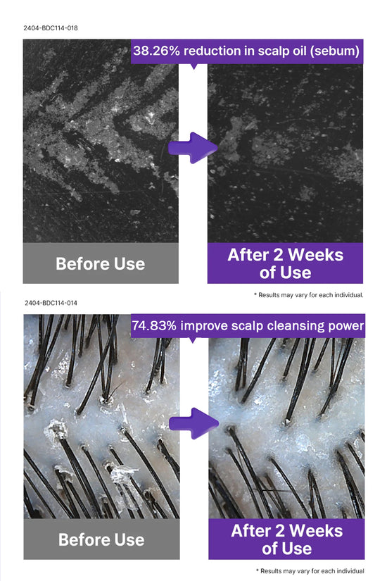 Dr. Oracle Scalp Pore Control Shampoo – Deep Cleansing & Scalp Renewal with PDRN, Plant Proteins & Peptides (380ml / 12.85 fl.oz)