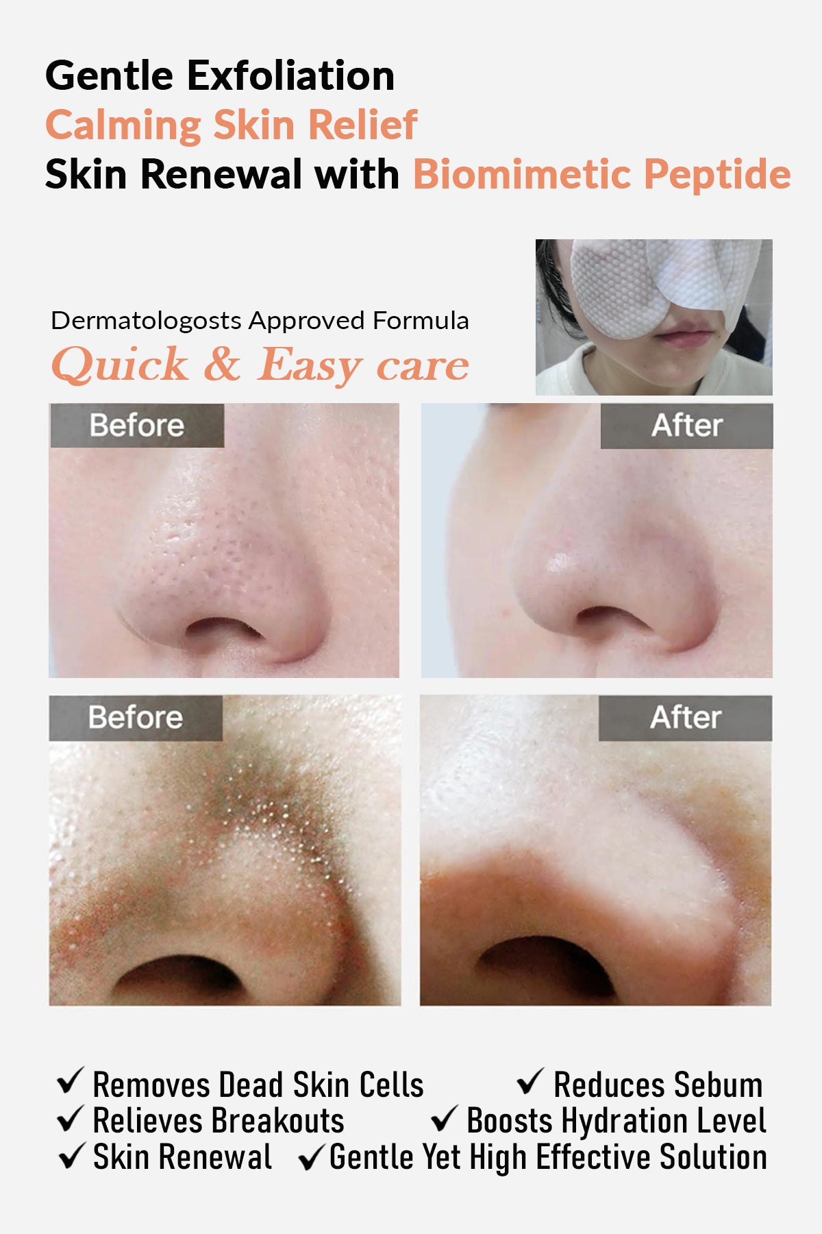 NizNoT 01  4HA SKIN PEEL DAILY TONER PAD 170ml/60 pads