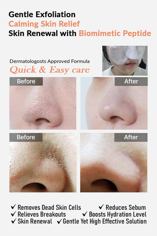 NizNoT 01  4HA SKIN PEEL DAILY TONER PAD 170ml/60 pads