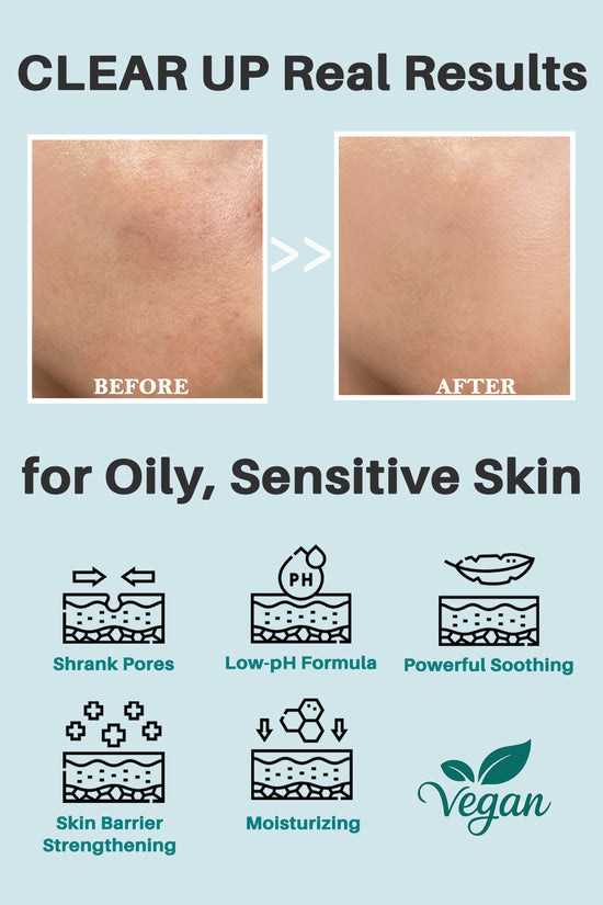 Thelavicos Tea Tree Cica 60 Moisturizer 110ml/3.71 fl.oz | Soothing for Acne, Sensitive Skin