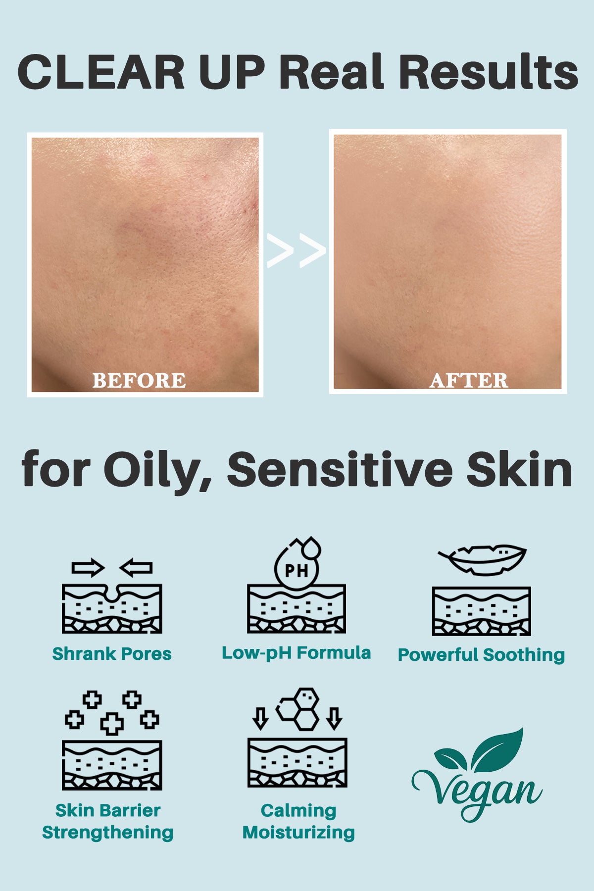 Thelavicos Tea Tree Cica 80 Toner 300ml/10.14 fl.oz | Your Daily pH-Balanced Ritual for Soothed, Clear Skin