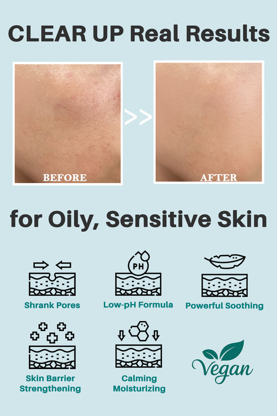 Thelavicos Tea Tree Cica 80 Toner 300ml/10.14 fl.oz | Your Daily pH-Balanced Ritual for Soothed, Clear Skin